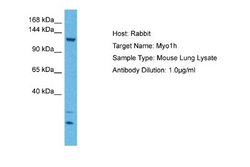 MYO1H Rabbit anti-Mouse, Polyclonal, Novus Biologicals 0.1 mL | Buy Online | Novus Biologicals | Fisher Scientific